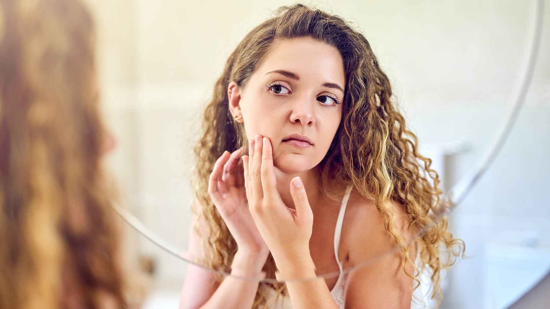 Know About Fungal Acne